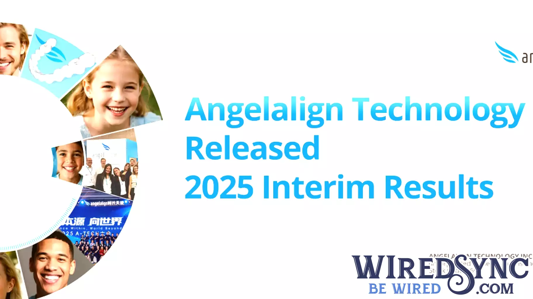 Angelalign Technology Reports Strong First-Half 2025 Performance Amid Increased Investments