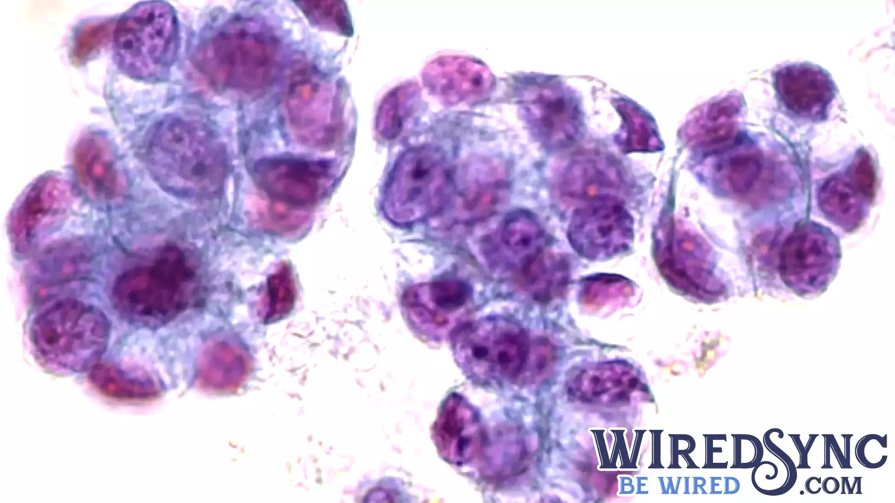 Innovative Organ Chip Technology Offers Hope for Predicting Chemotherapy Success in Esophageal Adenocarcinoma