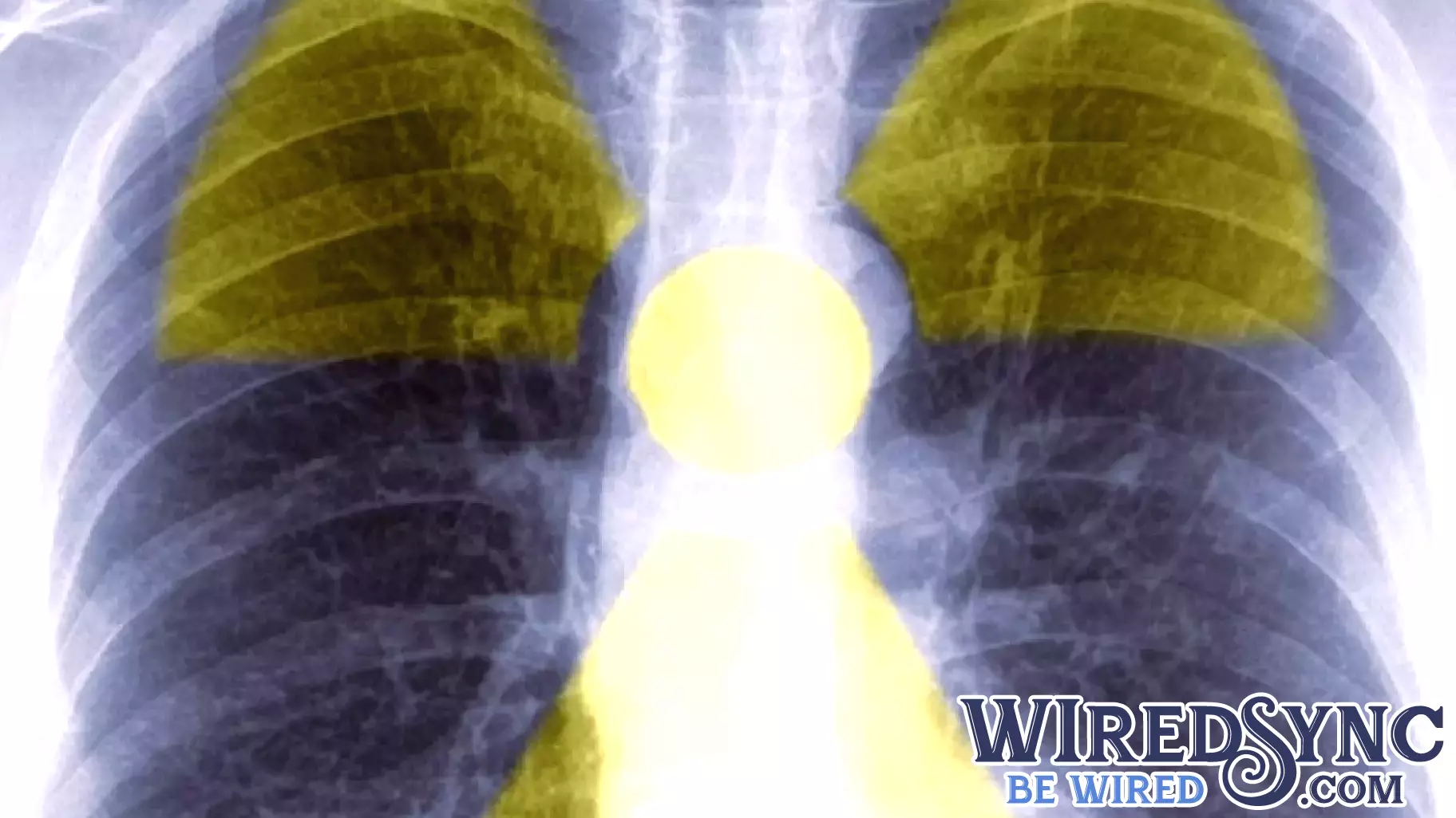 New portable PET technology guides procedures with real-time imaging