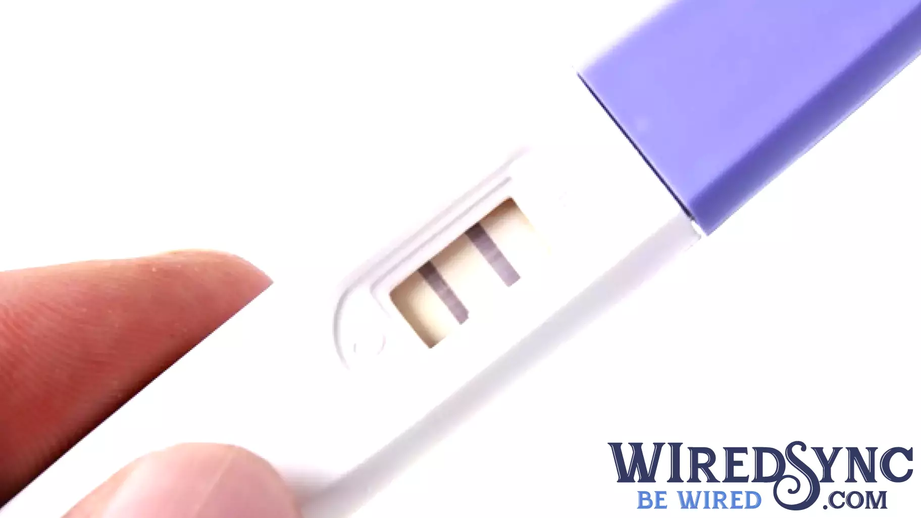 Pregnancy Risks Linked to Assisted Reproductive Technology in Kidney Transplant Recipients