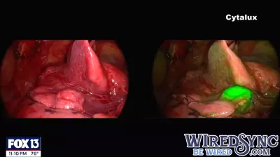 Innovative Technology Enhances Lung Cancer Detection